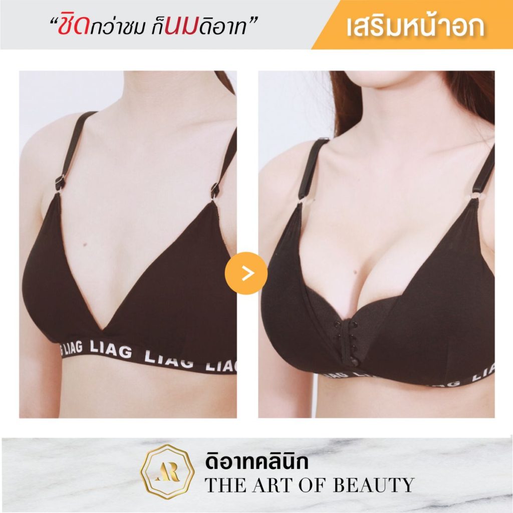 รีวิวทำนม